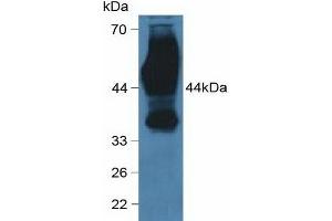 Detection of CD147 in Human Hela Cells using Polyclonal Antibody to Cluster Of Differentiation 147 (CD147) (CD147 anticorps  (AA 79-280))