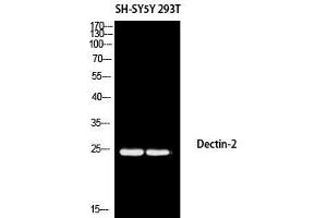 Western Blot (WB) analysis of SH-SY5Y 293T using Dectin-2 antibody. (C-Type Lectin Domain Family 6, Member A (CLEC6A) anticorps)