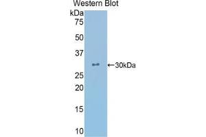 Western blot analysis of the recombinant protein. (CRYL1 anticorps  (AA 24-232))