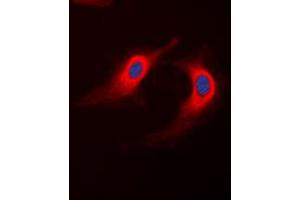 Immunofluorescent analysis of ABHD12B staining in K562 cells. (ABHD12B anticorps  (C-Term))