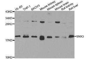 Western blot analysis of extracts of various cell lines, using SNX3 antibody. (Sorting Nexin 3 anticorps  (AA 1-162))