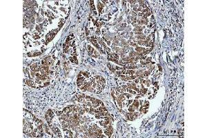 IHC analysis of FADS1 using anti-FADS1 antibody (ABIN7599175).