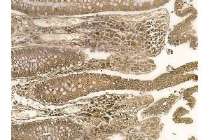 ZNF226 Mouse Monoclonal Antibody at 1/100 staining human normal colon tissue by IHC-P.