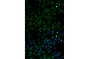 Immunofluorescence analysis of HeLa cell using VDAC1 antibody.