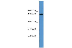 WB Suggested Anti-Igf2bp3 Antibody Titration: 0.