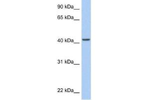 Human HeLa; WB Suggested Anti-ARID3C Antibody Titration: 0. (ARID3C anticorps  (C-Term))