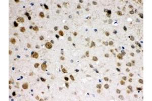 IHC testing of FFPE mouse brain with ABR antibody at 1ug/ml. (ABR anticorps)