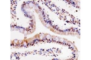 IHC testing of paraffin-embedded rat small intestine using Cdk4 antibody at 1:25.