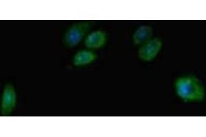 Immunofluorescent analysis of HepG2 cells using ABIN7171658 at dilution of 1:100 and Alexa Fluor 488-congugated AffiniPure Goat Anti-Rabbit IgG(H+L)
