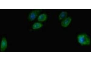 Immunofluorescent analysis of HepG2 cells using ABIN7171658 at dilution of 1:100 and Alexa Fluor 488-congugated AffiniPure Goat Anti-Rabbit IgG(H+L) (TBC1D7 anticorps  (AA 1-293))