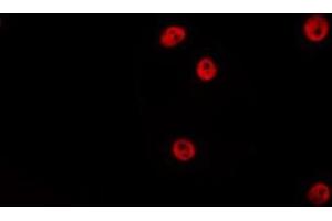 ABIN6275191 staining HepG2 by IF/ICC. (HOXA5 anticorps  (Internal Region))