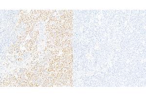 Immunohistochemistry (IHC) image for anti-Signal Transducer and Activator of Transcription 3 (Acute-Phase Response Factor) (STAT3) (pTyr705) antibody (ABIN7453986)