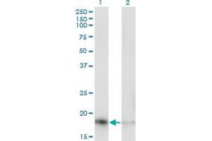 Western Blot analysis of RPL23A expression in transfected 293T cell line by RPL23A monoclonal antibody (M10), clone 3E11.