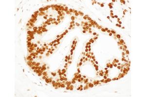 Immunohistochemistry (IHC) image for anti-SET Nuclear Oncogene (SET) (AA 175-225) antibody (ABIN7454813)