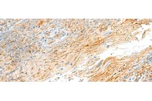 Immunohistochemistry of paraffin-embedded Human tonsil tissue using MRPS18B Polyclonal Antibody at dilution of 1:55(x200) (MRPS18B anticorps)
