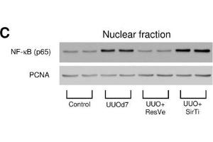 Changes in important mediators of inflammation and fibrosis in the obstructed kidney 7 days after UUO and the effects of Sirt1 activation or inhibition. (PCNA anticorps)