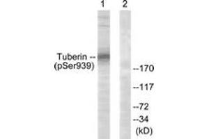 Western blot analysis of extracts from 293 cells treated with Anisomycin 25ug/ml 30', using Tuberin/TSC2 (Phospho-Ser939) Antibody. (Tuberin anticorps  (pSer939))