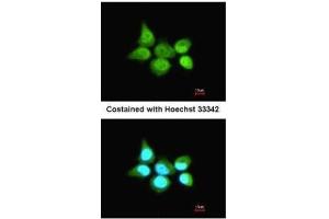 ICC/IF Image Immunofluorescence analysis of paraformaldehyde-fixed A431, using SSA1, antibody at 1:200 dilution. (TRIM21 anticorps)