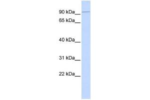 WB Suggested Anti-KIFC2 Antibody Titration:  0. (KIFC2 anticorps  (N-Term))