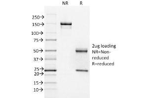 SDS-PAGE Analysis Purified FOXA1 Monoclonal Antibody (FOXA1/1518). (FOXA1 anticorps  (AA 372-472))