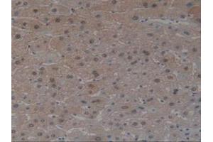 IHC-P analysis of Human Liver Tissue, with DAB staining. (Angiotensin I Converting Enzyme 1 anticorps  (AA 1160-1306))