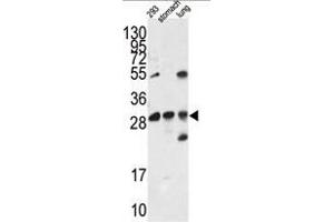 Western blot analysis of EN2 antibody (C-term) in 293 cell line lysates and mouse stomach and lung tissue lysates (35ug/lane).