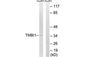 Western blot analysis of extracts from HuvEc cells, using TMBIM1 Antibody. (TMBIM1 anticorps  (AA 251-300))