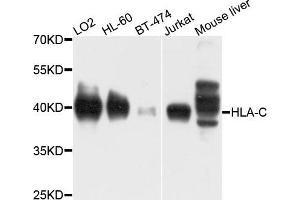 Western blot analysis of extracts of various cells, using HLA-C antibody. (HLA-C anticorps)