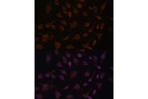 Immunofluorescence analysis of C6 cells using  antibody (ABIN6131164, ABIN6136413, ABIN6136415 and ABIN6217209) at dilution of 1:100.