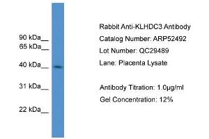 WB Suggested Anti-KLHDC3  Antibody Titration: 0.