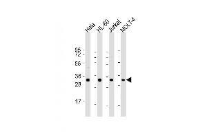 All lanes : Anti-OPN-a/b Antibody (N-term) at 1:2000 dilution Lane 1: Hela whole cell lysate Lane 2: HL-60 whole cell lysate Lane 3: Jurkat whole cell lysate Lane 4: MOLT-4 whole cell lysate Lysates/proteins at 20 μg per lane. (OPN-A,b (AA 14-40), (N-Term) anticorps)