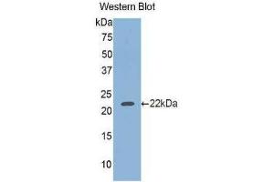 Western Blotting (WB) image for anti-Glucosidase, Beta, Acid (GBA) (AA 334-498) antibody (ABIN1858968) (GBA anticorps  (AA 334-498))