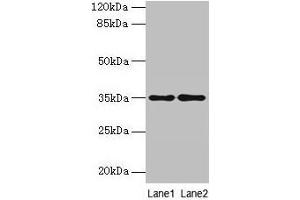 Western blot All lanes: SDSL antibody at 4 μg/mL Lane 1: HepG2 whole cell lysate Lane 2: Mouse liver tissue Secondary Goat polyclonal to rabbit IgG at 1/10000 dilution Predicted band size: 35 kDa Observed band size: 35 kDa (SDSL anticorps  (AA 39-169))