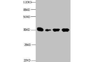 All lanes: Mouse anti- Human Insulin-like growth factor-binding protein 1 monoclonal antibody at 1 μg/mL Lane 1:Pyrolysis liquid human placental tissue 7. (IGFBPI anticorps)
