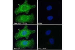 ABIN190916 Immunofluorescence analysis of paraformaldehyde fixed HeLa cells, permeabilized with 0.