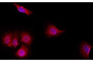 ABIN6257071 and ABIN6274969 staining Hela by IF/ICC. (CPE anticorps  (Internal Region))
