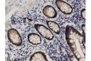 Immunoperoxidase of monoclonal antibody to STK38L on formalin-fixed paraffin-embedded human small Intestine.
