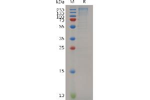 Mouse L Protein, His Tag on SDS-PAGE under reducing condition.