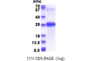SDS-PAGE (SDS) image for Chondrolectin (CHODL) (AA 22-216) protein (His tag) (ABIN5853703)