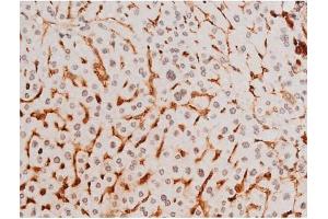 ABIN6267524 at 1/200 staining Mouse liver tissue sections by IHC-P.