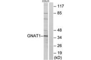 Western blot analysis of extracts from COLO cells, using GNAT1 Antibody. (GNAT1 anticorps  (AA 71-120))