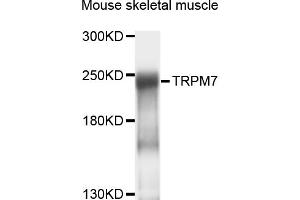 Western blot analysis of extracts of mouse skeletal muscle, using TRPM7 antibody (ABIN4905504) at 1:1000 dilution. (TRPM7 anticorps)