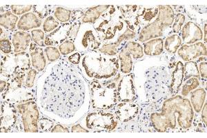 Immunohistochemical analysis of paraffin-embedded Human kidney section using Pink1 (ABIN1538954 and ABIN2849886). (FH anticorps  (N-Term))