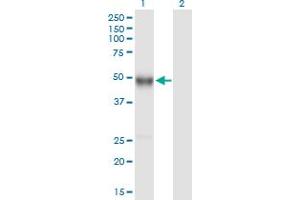 Western Blot analysis of IGHG4 expression in transfected 293T cell line by IGHG4 MaxPab polyclonal antibody. (IGHG4 anticorps  (AA 1-473))