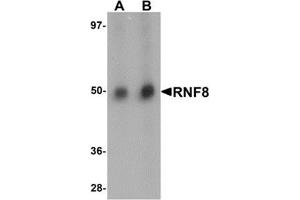 Western blot analysis of RNF8 in human lung tissue lysate with RNF8 antibody at (A) and (B) 2 μg/ml. (RNF8 anticorps  (C-Term))