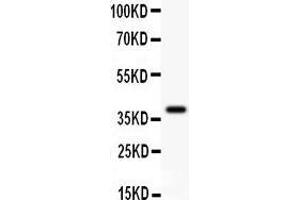 Anti- GAD67 Picoband antibody, Western blotting All lanes: Anti GAD67  at 0.