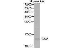 Western Blotting (WB) image for anti-Serum Amyloid A1 (SAA1) (AA 19-122) antibody (ABIN3022331) (SAA1 anticorps  (AA 19-122))