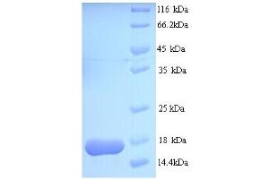 SDS-PAGE (SDS) image for ATP-Binding Cassette, Sub-Family B (MDR/TAP), Member 1B (ABCB1B) (AA 1-114), (full length) protein (His tag) (ABIN5713190)