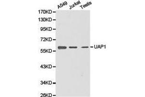 Western Blotting (WB) image for anti-UDP-N-Acteylglucosamine Pyrophosphorylase 1 (UAP1) antibody (ABIN1875243) (UAP1 anticorps)
