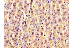 IHC image of ABIN7143542 diluted at 1:1200 and staining in paraffin-embedded human liver tissue performed on a Leica BondTM system.